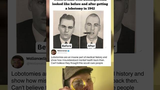 They did what to this Schizophrenic man️🪓 They did what to this Schizophrenic man️🪓