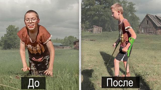 ДЦП ЛЕЧИТСЯ.Дети ползали а теперь стали на ноги. ДЦП ЛЕЧИТСЯ.Дети ползали а теперь стали на ноги.