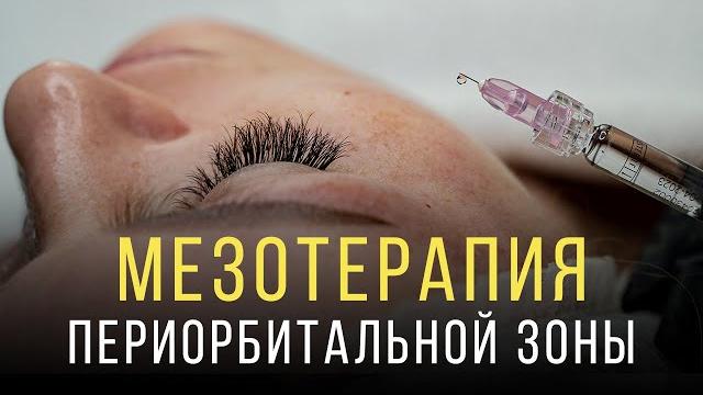 Мезотерапия вокруг глаз Мезотерапия вокруг глаз