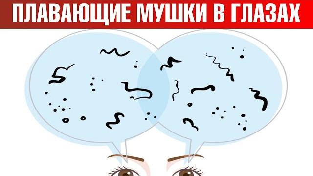 Как избавиться от мушек в глазах? Мушки перед глазами: причины Как избавиться от мушек в глазах? Мушки перед глазами: причины