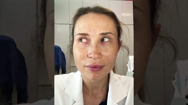 Аллергический конъюнктивит Как справиться? Аллергический конъюнктивит Как справиться?