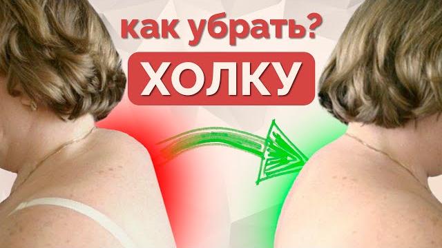 Как убрать вдовий горб? Упражнения от холки. Как убрать вдовий горб? Упражнения от холки.