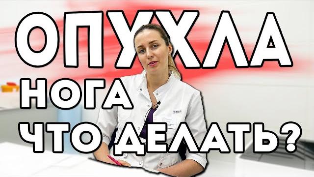 Что делать если опухла нога? К какому врачу идти? Что делать если опухла нога? К какому врачу идти?