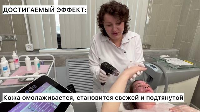 RF лифтинг кистей рук Inmode Morpheus 8 RF лифтинг кистей рук Inmode Morpheus 8