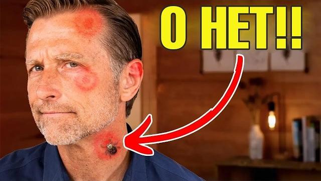 Как предотвратить боррелиоз (болезнь Лайма)? Как предотвратить боррелиоз (болезнь Лайма)?