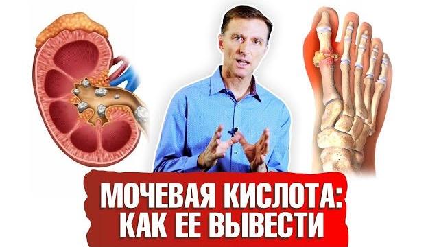 Мочевая кислота. Как вывести ее из организма? ️ Мочевая кислота. Как вывести ее из организма? ️