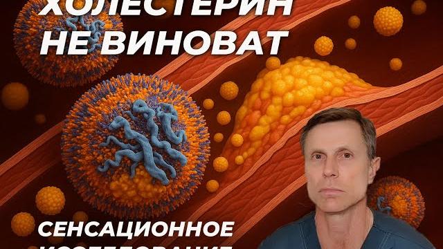Сенсационное исследование : бляшки в сосудах не связаны с высоким холестерином. Революция в науке! Сенсационное исследование : бляшки в сосудах не связаны с высоким холестерином. Революция в науке!