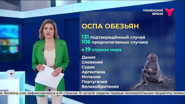 Оспа обезьян Оспа обезьян