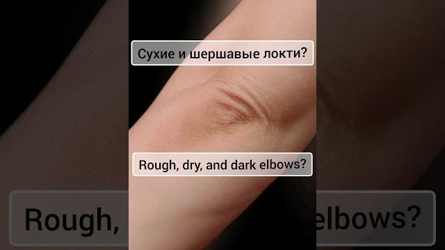Сухие и шершавые локти |Rough and Dry Elbows Сухие и шершавые локти |Rough and Dry Elbows