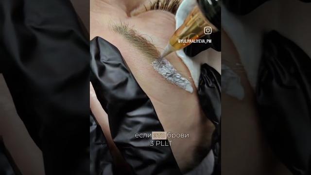 Удаление татуажа бровей ремувером ревайвинк плюс Удаление татуажа бровей ремувером ревайвинк плюс
