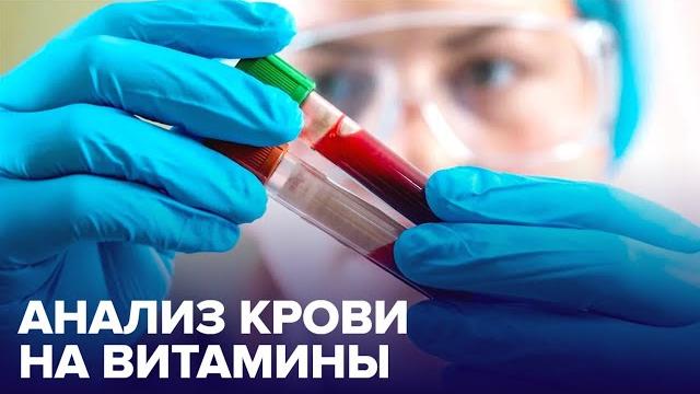 Анализ крови на ВИТАМИНЫ: кому он нужен? Анализ крови на ВИТАМИНЫ: кому он нужен?