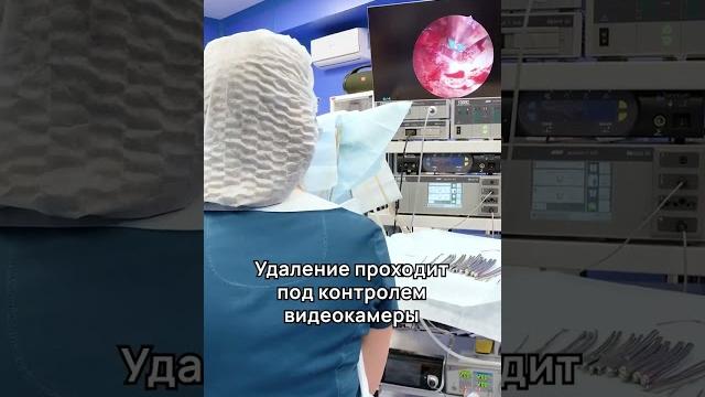 Как проходит гистероскопия? Удаление полипа в матке. Как проходит гистероскопия? Удаление полипа в матке.
