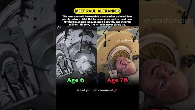 Paul Alexander: Iron Lung Survivor Became a Lawyer #paulalexander #ironlung #lawyer #author #polio Paul Alexander: Iron Lung Survivor Became a Lawyer #paulalexander #ironlung #lawyer #author #polio