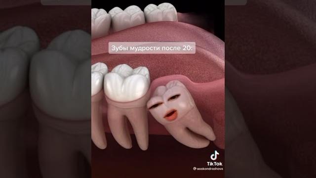 Зубы мудрости в деле ¦ Суета ¦ Funy video ¦ Best Cube #приколы #мем #funny #fun #bestcube #cube Зубы мудрости в деле ¦ Суета ¦ Funy video ¦ Best Cube #приколы #мем #funny #fun #bestcube #cube