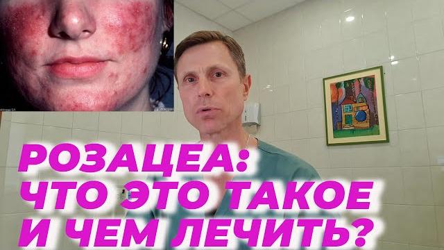 Розацеа: что это такое и чем лечить. Розацеа: что это такое и чем лечить.