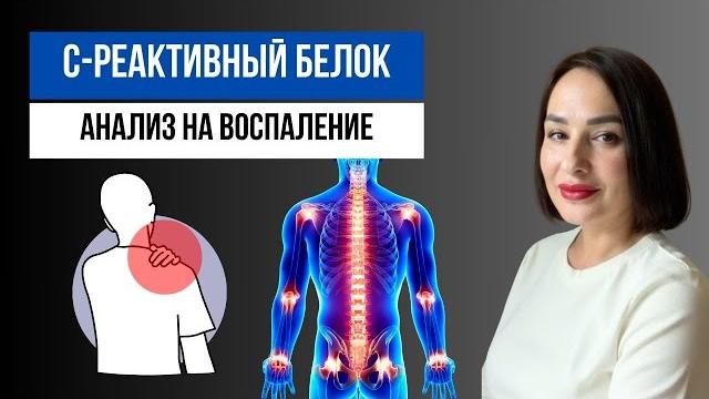 Анализ на воспаление: С-реактивный белок Анализ на воспаление: С-реактивный белок