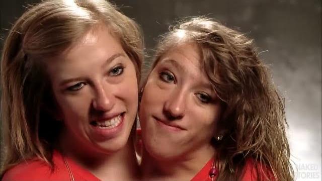 Abby and Brittany Hensel: Conjoined Twins - Quick Q&A Abby and Brittany Hensel: Conjoined Twins - Quick Q&A