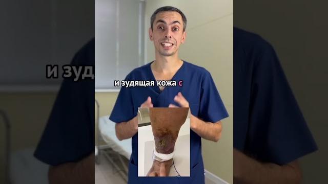 У тебя постоянно чешутся ноги? А помимо этого есть выпирающие вены? #варикоз#shorts#флеболог#рек У тебя постоянно чешутся ноги? А помимо этого есть выпирающие вены? #варикоз#shorts#флеболог#рек