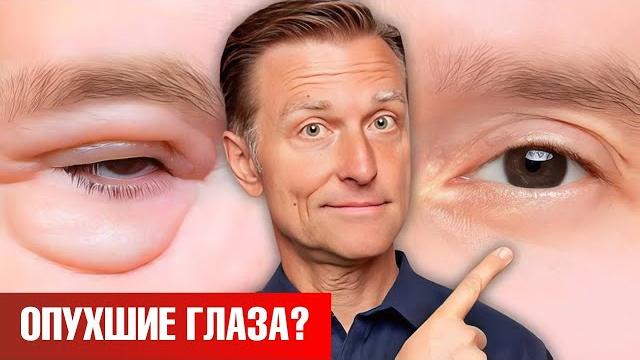 Как убрать мешки под глазами НАВСЕГДА? Как убрать мешки под глазами НАВСЕГДА?