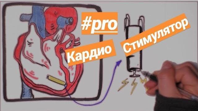 Про кардиостимулятор | Рентген-кабинет Про кардиостимулятор | Рентген-кабинет