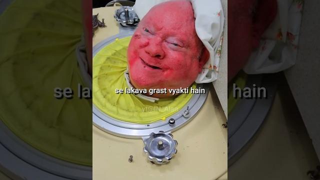 Man with Iron Lungs 🫁 Man with Iron Lungs 🫁