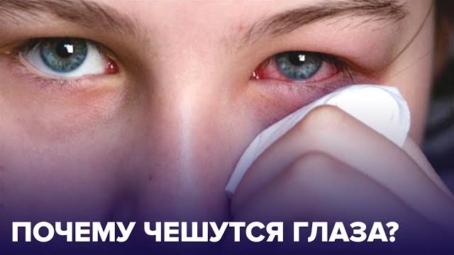 Чешутся ГЛАЗА: возможные ПРИЧИНЫ ЗУДА Чешутся ГЛАЗА: возможные ПРИЧИНЫ ЗУДА