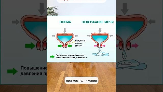 ПРОСТОЕ упражнение от недержания мочи в любом возрасте ПРОСТОЕ упражнение от недержания мочи в любом возрасте