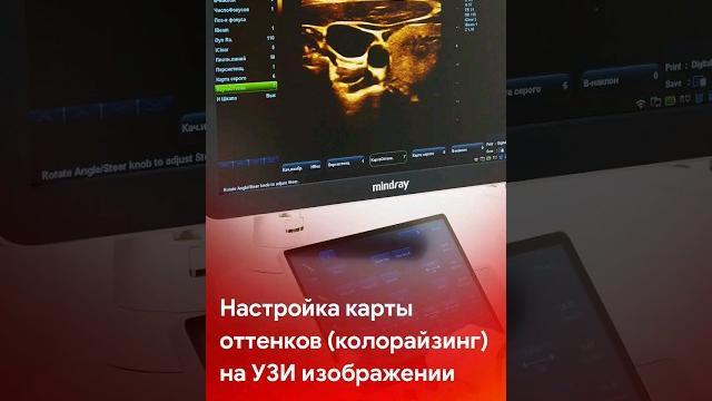 Настройка карты оттенков (колорайзинг) на УЗИ изображении. Советы врача на @medliga #short #shorts Настройка карты оттенков (колорайзинг) на УЗИ изображении. Советы врача на @medliga #short #shorts