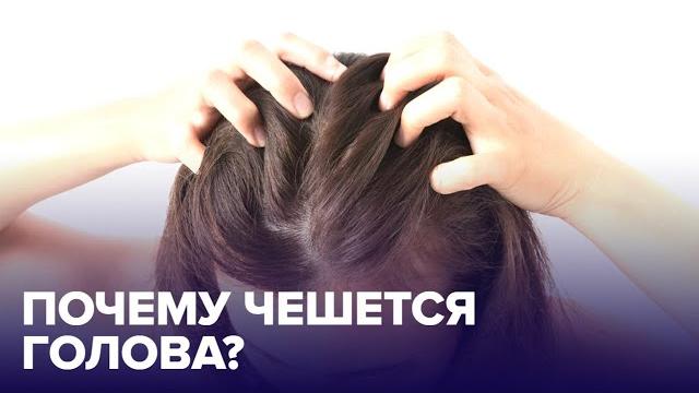 Почему ЧЕШЕТСЯ ГОЛОВА и как избавиться от ЗУДА? Почему ЧЕШЕТСЯ ГОЛОВА и как избавиться от ЗУДА?