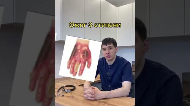 Что нужно знать про ожоги. Доктор Садыков Что нужно знать про ожоги. Доктор Садыков