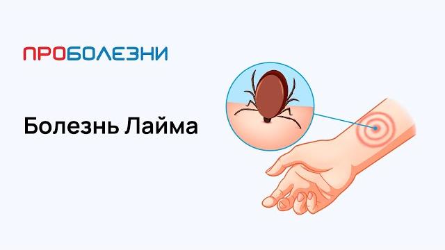 Болезнь Лайма Болезнь Лайма