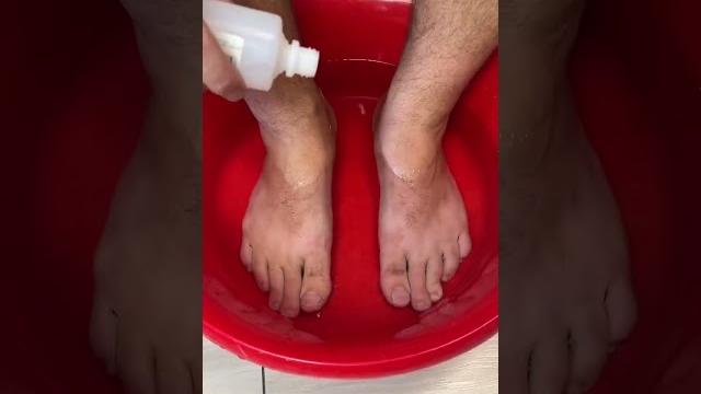 Как избавиться от трещин на пятках Как избавиться от трещин на пятках