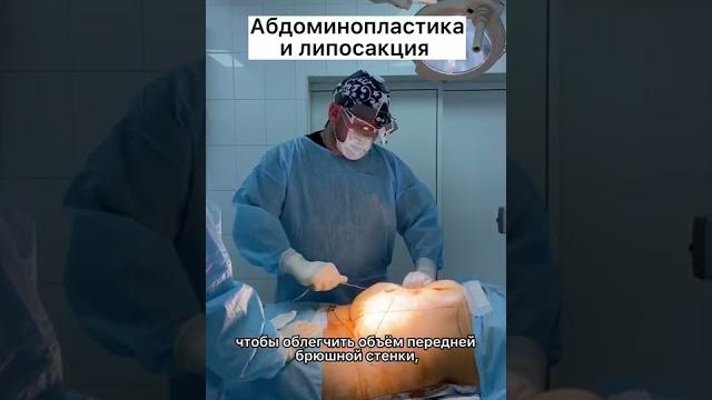 Абдоминопластика и липосакция живота Абдоминопластика и липосакция живота