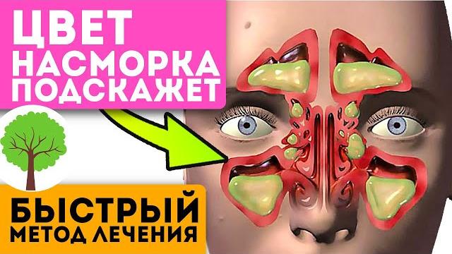Если у вас зеленые сопли, значит, поможет только… Если у вас зеленые сопли, значит, поможет только…