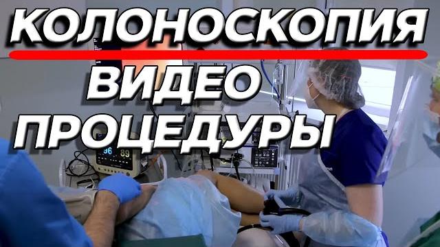 Колоноскопия под наркозом: как проводится исследование Колоноскопия под наркозом: как проводится исследование