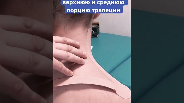 Кинезио тейп при болях в шее Кинезио тейп при болях в шее
