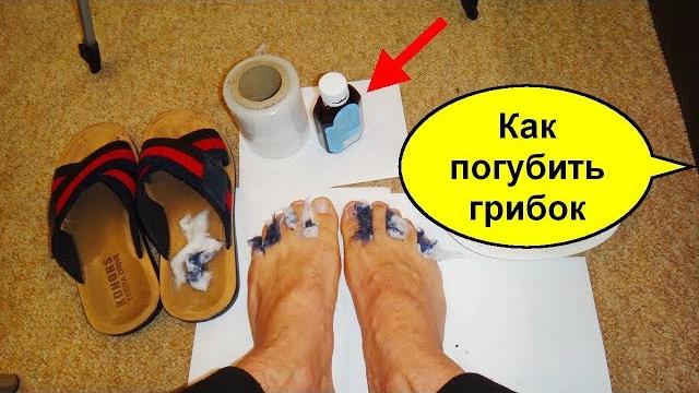 Если чешутся пальцы на ногах это грибок кожи? Этого дешевого средства грибок боится как огня Если чешутся пальцы на ногах это грибок кожи? Этого дешевого средства грибок боится как огня